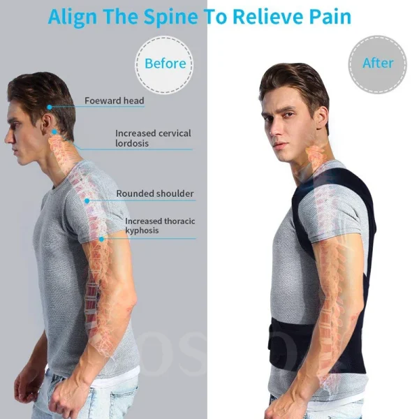 Posture Corrector for Men and Women Back Posture Brace Clavicle Support Stop Slouching and Hunching Adjustable Back Trainer - Image 2