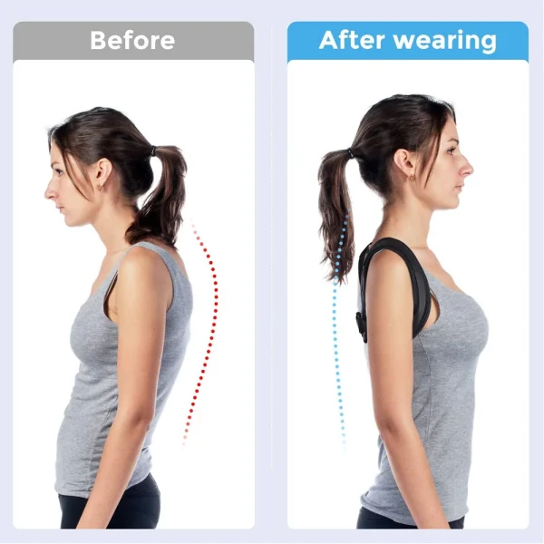 Adjustable Back Posture Corrector Preventing Humpback Upper Back Neck Brace Shoulder Back Correction Belt Spine Pain Relief - Image 3