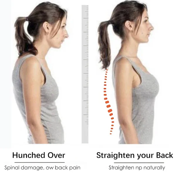 Smart Posture Corrector Miicro Vibration Posture Training Reminder Sensor Back Posture Neck Hump Corrector for Adult Kids - Image 4