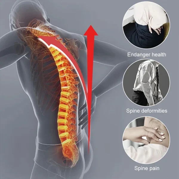 Adjustable Back Brace Posture Corrector Women Men Back Straightener Trainer for Scoliosis & Hunchback Correction, Spine Support - Image 3